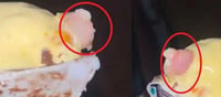 VIDEO - Doctor finds piece of flesh with nail in butterscotch ice-cream cone